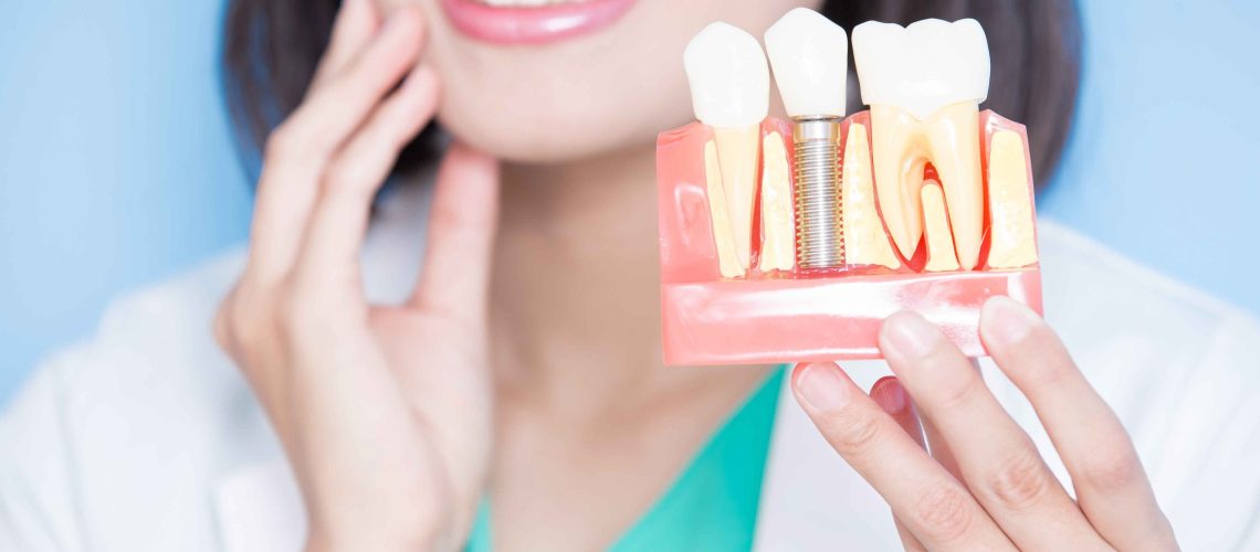 dental implants recovery-dental costs australia