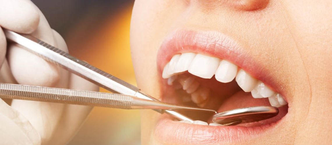 wisdom teeth removal recovery - dental costs australia